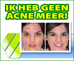Derminax - acne